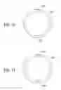 Fig. 12 - CATHETER EXTRACTION