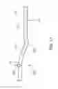 Fig. 17 - Tissue-removing catheter including urging mechanism