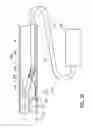 Fig. 26 - Tissue-removing catheter including urging mechanism