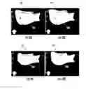 Fig. 09 - SYSTEM AND METHOD FOR ULTRASONICALLY SENSING AND ABLATING TISSUE