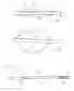 Fig. 09 - Thrombectomy devices and treatment of acute ischemic stroke with thrombus engagement