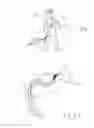 Fig. 14 - Thrombectomy devices and treatment of acute ischemic stroke with thrombus engagement