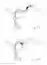 Fig. 16 - Thrombectomy devices and treatment of acute ischemic stroke with thrombus engagement