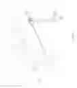 Fig. 07 - VASCULAR ACCESS CONFIGURATION