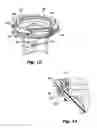 Fig. 06 - Multi-port access device for minimally invasive surgical procedures