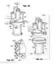 Fig. 21 - Multi-port access device for minimally invasive surgical procedures