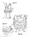 Fig. 23 - Multi-port access device for minimally invasive surgical procedures
