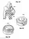 Fig. 33 - Multi-port access device for minimally invasive surgical procedures