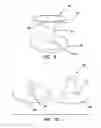 Fig. 07 - Systems and methods for tissue removal