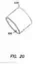 Fig. 14 - Trocar cannula assembly with low profile insertion configuration and method of manufacture