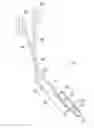 Fig. 01 - Catheter extraction