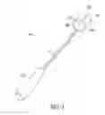 Fig. 04 - Catheter extraction