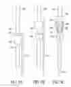 Fig. 06 - Catheter extraction
