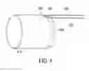 Fig. 09 - Catheter extraction