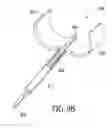 Fig. 11 - Catheter extraction