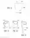 Fig. 13 - Catheter extraction