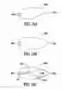 Fig. 14 - Catheter extraction