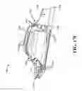 Fig. 16 - Catheter extraction