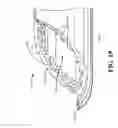 Fig. 20 - Catheter extraction