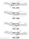Fig. 21 - Catheter extraction