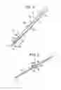 Fig. 03 - Surgical instrument having a stop guard