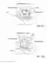 Fig. 18 - METHODS AND APPARATUS FOR PREVENTING VAGINAL LACERATIONS DURING CHILDBIRTH