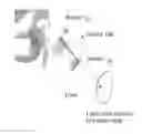 Fig. 01 - Methods and apparatus for internal hip distraction
