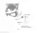 Fig. 03 - Methods and apparatus for internal hip distraction