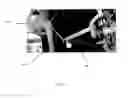 Fig. 04 - Methods and apparatus for internal hip distraction