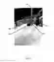 Fig. 06 - Methods and apparatus for internal hip distraction