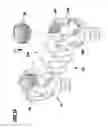 Fig. 13 - Connection element and spine stabilization system