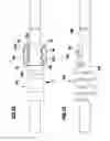 Fig. 18 - Connection element and spine stabilization system