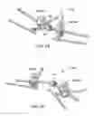 Fig. 17 - Pedicle screw having a removable rod coupling