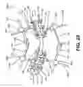 Fig. 20 - Pedicle screw having a removable rod coupling