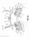 Fig. 24 - Pedicle screw having a removable rod coupling