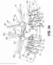 Fig. 25 - Pedicle screw having a removable rod coupling