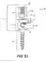 Fig. 43 - Pedicle screw having a removable rod coupling