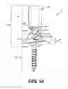 Fig. 46 - Pedicle screw having a removable rod coupling