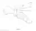 Fig. 23 - Method and appparatus for an intramedullary implant and method of implantation therefor