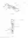 Fig. 46 - Method and appparatus for an intramedullary implant and method of implantation therefor