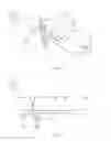 Fig. 49 - Method and appparatus for an intramedullary implant and method of implantation therefor