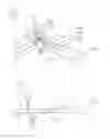 Fig. 50 - Method and appparatus for an intramedullary implant and method of implantation therefor