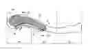 Fig. 01 - THREE-DIMENSIONAL FRACTURE FIXATION DEVICE FOR NERVE PROTECTION