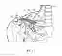 Fig. 02 - THREE-DIMENSIONAL FRACTURE FIXATION DEVICE FOR NERVE PROTECTION