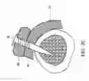 Fig. 05 - THREE-DIMENSIONAL FRACTURE FIXATION DEVICE FOR NERVE PROTECTION