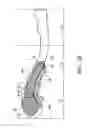 Fig. 07 - THREE-DIMENSIONAL FRACTURE FIXATION DEVICE FOR NERVE PROTECTION