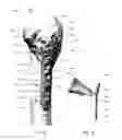 Fig. 02 - Proximal humeral stabilization system