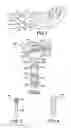 Fig. 02 - VOLAR FIXATION SYSTEM INCLUDING GUIDE