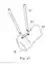 Fig. 17 - FLEXIBLE STAPLE