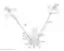 Fig. 01 - Systems and methods for vertebral or other bone structure height restoration and stabilization